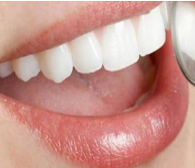 清洁牙齿表面方法