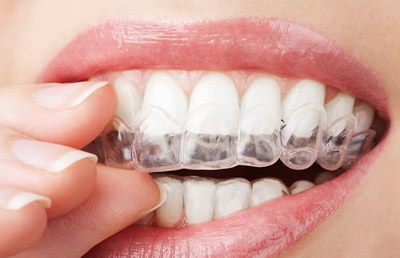 怎么看补牙用的什么材料_拔牙一周后就可以补牙吗