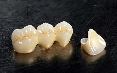 根管治疗临时补牙材料掉了_普通补牙和根管治疗的区别