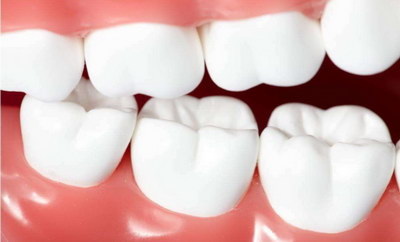 补牙玻璃离子可用几年(什么是玻璃离子补牙材料？)