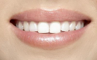 树脂补牙牙齿敏感