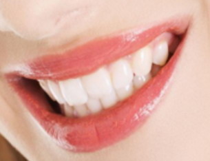 牙齿窝沟封闭能维持多久(什么是牙齿窝沟封闭？)