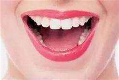 牙龈与牙齿有缝隙(牙齿和牙龈有缝隙)