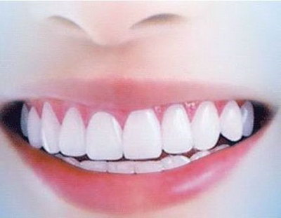牙齿下牙比上牙好修复吗[上牙齿把下牙齿全包进去叫什么]