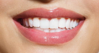 牙齿为什么要做牙套_牙套最里面的牙齿为什么没有