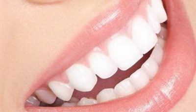 拔牙后多久可以镶假牙(何时可以进行假牙镶接？)