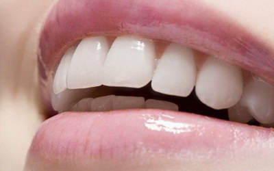 怎么解决牙齿牙垢问题