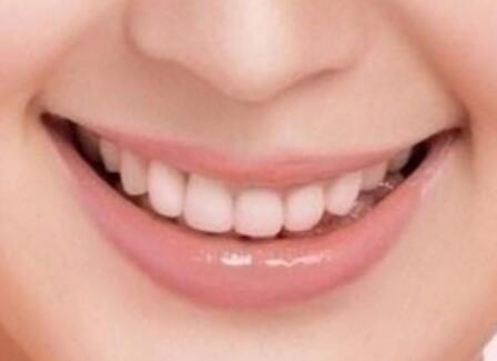 牙齿和牙龈的缝隙变黑_牙齿和牙龈的缝隙变黑出血