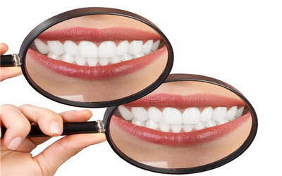 牙齿咬合面磨损能修复吗(什么是以牙齿咬合面磨损？)
