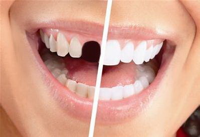 牙齿蛀牙还有救吗_成年男性的牙齿还能矫正吗