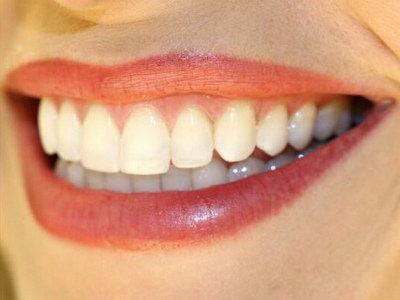 修复牙釉质是什么意思
