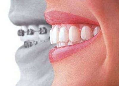 成年男性的牙齿还能矫正吗?