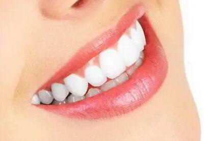 隐形牙套的优点(革命性的牙齿矫正方式——隐形牙套)