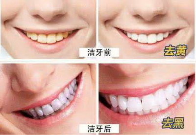 天津可以使用报销的人牙科医院