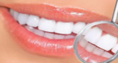 全瓷贴面对牙齿有伤害吗?