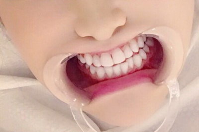 来月经期间牙齿出血是什么原因_牙齿要涂氟