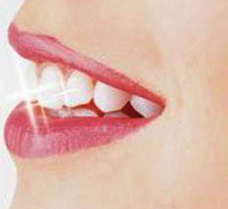 牙齿容易坏是什么原因引起的(牙齿容易破裂是什么原因)