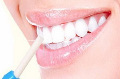 矫正牙齿最快的方式是什么