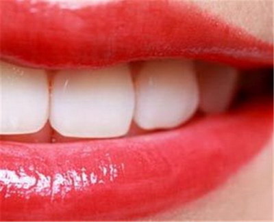 进口树脂和国产树脂补牙_经常补牙会不会对牙伤害大