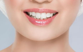 牙齿上面的黑线是什么(牙齿上面的缝隙有黑线)