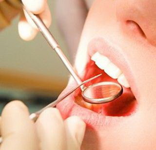 临时补牙材料能用多久(什么是临时补牙材料？)