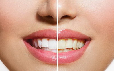 吃酸东西牙齿酸是什么原因