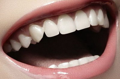 种植牙牙龈和牙冠有黑色缝隙