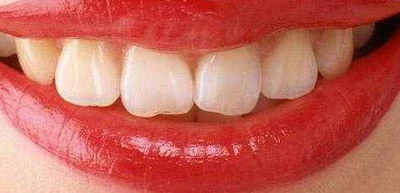 全锆牙和二氧化锆的区别_全锆牙可以做核磁共振吗