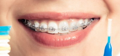 乳牙能保存多久_乳牙之间怎么接触