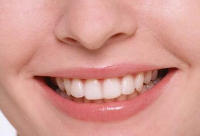 牙齿矫正都有什么方法可以呢？