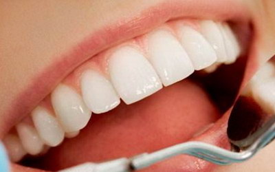 镶牙一颗牙齿能戴三颗吗?