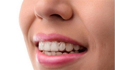 氧化锆牙齿寿命是多久(氧化锆瓷牙的优点)