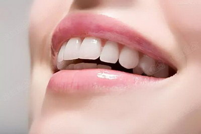 牙齿矫正牙套原理(牙齿矫正牙套多长时间能拿掉)