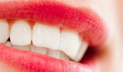 成年人牙齿可以正畸吗