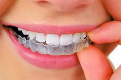 怎么使牙齿变白方法_如何使黄牙齿变为白牙齿