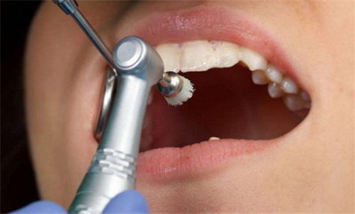牙齿蛀空的补救方法「牙齿发育不良有什么补救的方法」