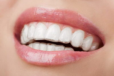 打桩治疗的牙齿能管多少年(打桩治疗的牙齿能管多少年)