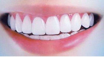 拆种植牙齿可怕吗(什么是拆种植牙齿？)