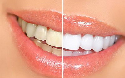牙龈跟牙齿分离是什么原因很多年了_牙龈跟牙齿分离怎么治疗