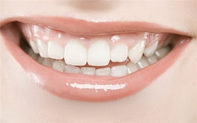 门牙缺失矫正时就空着吗「门牙缺失矫正与修复」