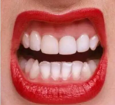 为什么牙齿每个月都会痛