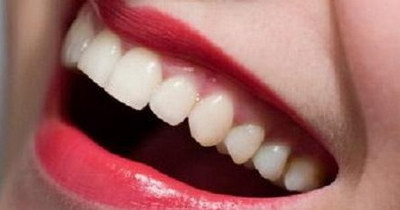 正畸如何避免牙龈萎缩牙周炎