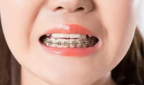 有什么方法可以防蛀牙(儿童乳牙蛀牙疼有什么方法可以解决)