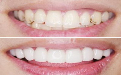 人的上排牙齿有几颗(上排牙齿有几颗乳牙)