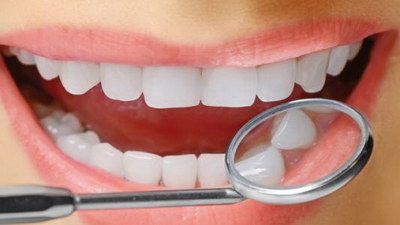 牙齿溃疡怎么造成的【牙齿溃疡怎么治疗最好】