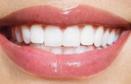 牙齿打桩做冠可以维持多久