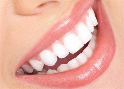 成年人牙齿整形要多久?