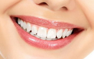 怎样可以让牙齿变白小窍门_深圳牙齿缺损的修复