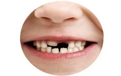 拔牙后牙槽骨萎缩(拔牙后牙槽骨会萎缩吗)