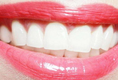 全口无牙颌种植临时牙_口内自凝制作临时牙冠